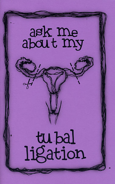 Ask Me About My Tubal Ligation