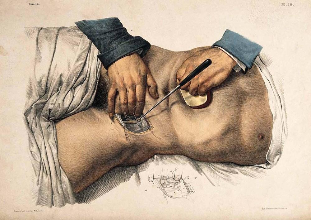 Crucial Interventions: An Illustrated Treatise on the Principles & Practice of Nineteenth-Century Surgery image #1
