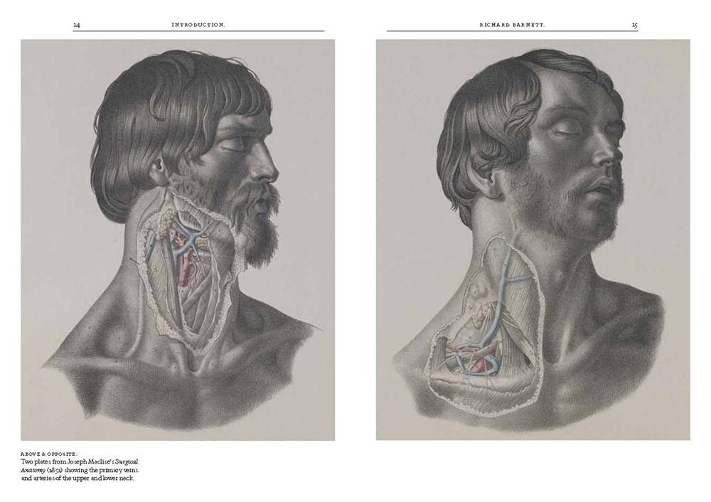 Crucial Interventions: An Illustrated Treatise on the Principles & Practice of Nineteenth-Century Surgery image #3