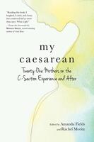 My Caesarean: Twenty-One Mothers on the C-Section Experience and After