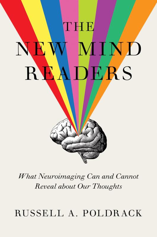 rainbow stems from a brain