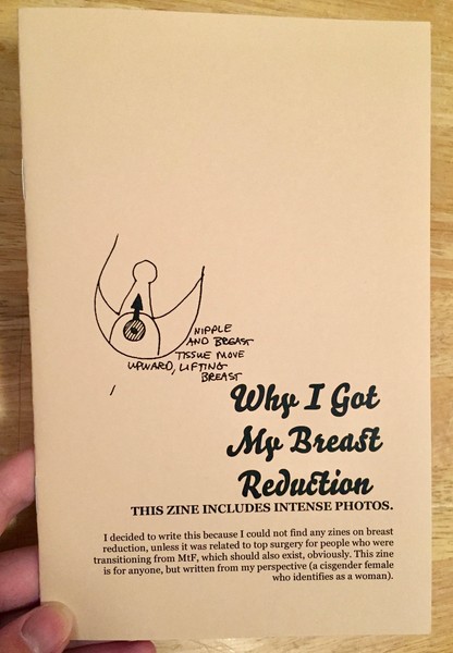 Why I Got My Breast Reduction zine cover